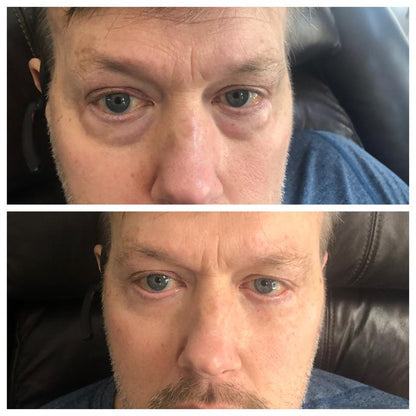 Instant Oogkringen- en Rimpelcrème