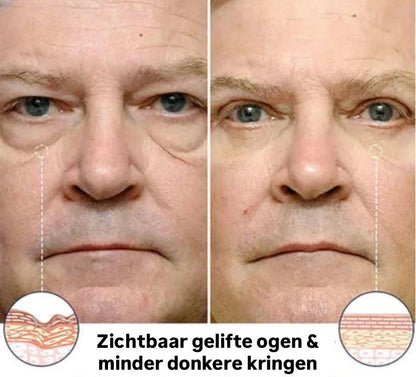 Instant Oogkringen- en Rimpelcrème