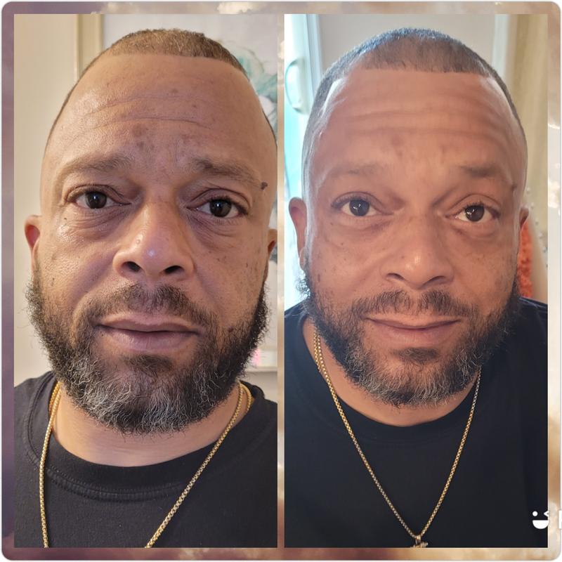 Instant Oogkringen- en Rimpelcrème