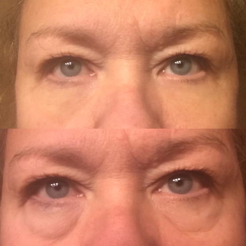 Instant Oogkringen- en Rimpelcrème