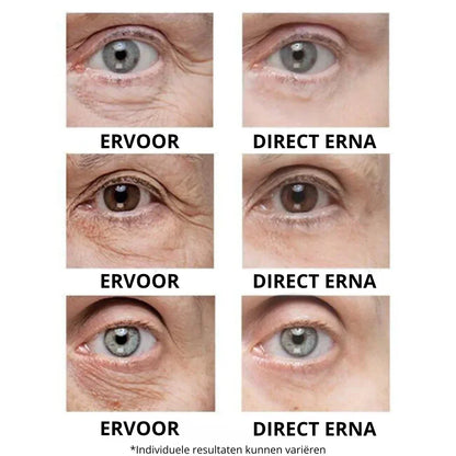 Instant Oogkringen- en Rimpelcrème