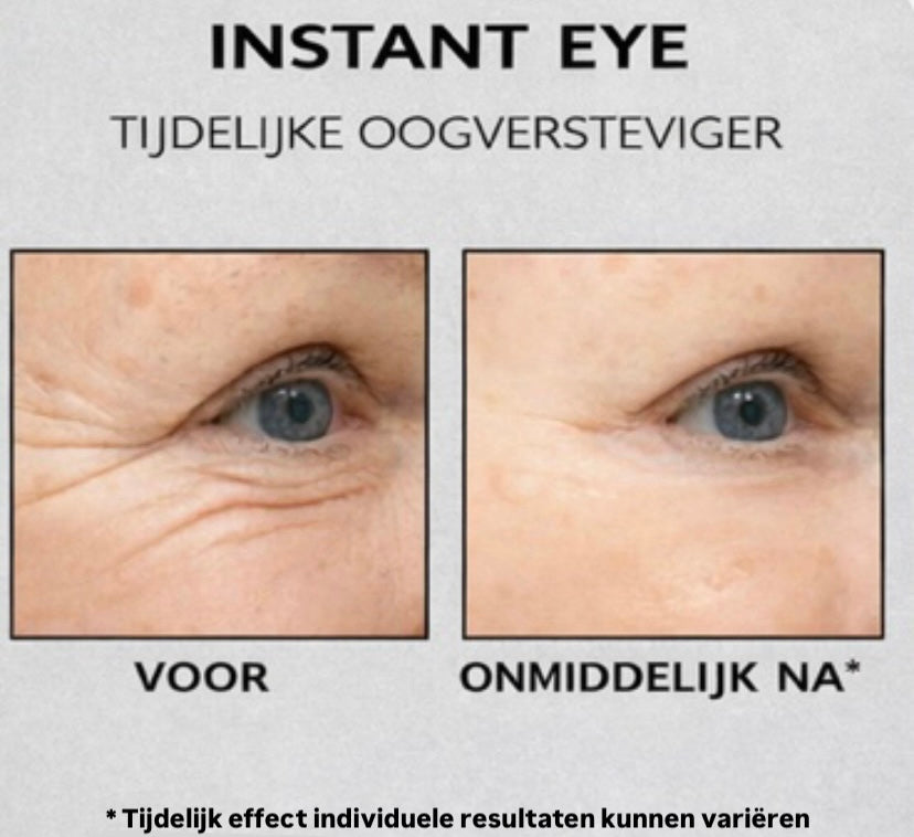 Instant Oogkringen- en Rimpelcrème