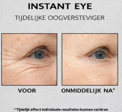Instant Oogkringen- en Rimpelcrème